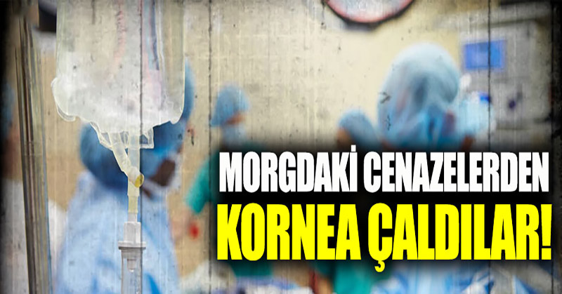 Morgdaki cenazelerden kornea çaldılar iddiası